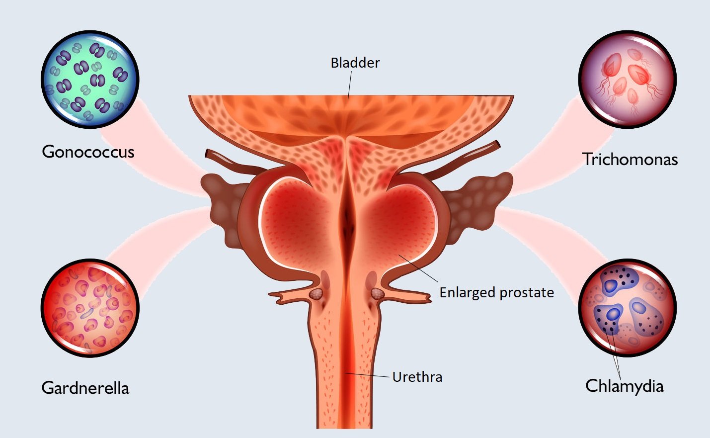 STD symptoms